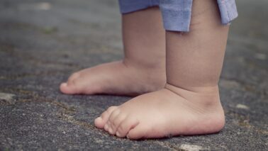 1—5aastaste laste levinumad kõndimisega seotud probleemid